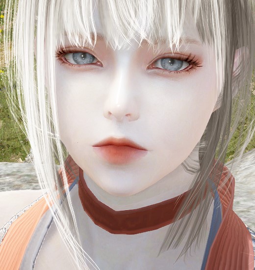 MG